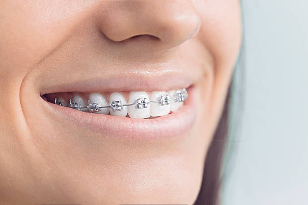 Best Veneers and Lumineers  in Saukville, WI